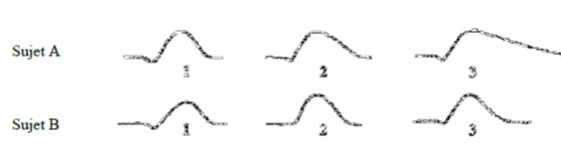 POTENTIEL D ACTION.jpg